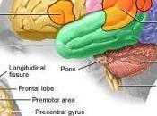 Aphasia: Frightening Symptom