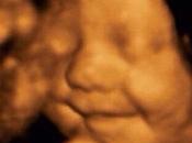 Creation: Ultrasound Shows Baby Smiling Womb