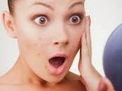 Acne Story Life Dealt with