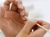 Home Remedies Peeling Cuticles