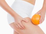 Myths About Cellulite