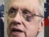 Harry Reid Blinded from Year’s “exercise” Injuries