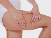 Treat Pesky Cellulite With Biopolar Radiofrequency Energy