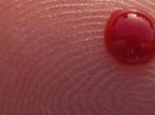 HbA1c: Biomarker Health