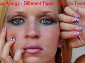 Makeup Allergy Reactions, Types, Treat Them