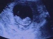 Ultrasound Shows Demon Womb