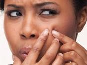 Mistakes Make When Have Zits