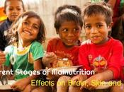 Malnutrition Stages: Effects Brain, Skin Body