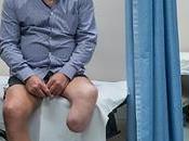 Amputations Diabetes Cent Years