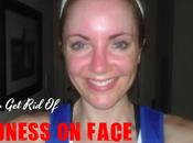 Redness Face: Remedies Tips