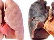 Here’s Clean Detoxify Your Lungs Days