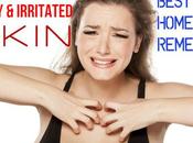 Itchy Irritated Skin: Best Home Remedies