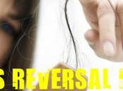 Different Hair Loss Reversal Methods Stop Baldness