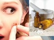 Homeopathy Treatment Skin Diseases (Rashes, Allergies, Etc)