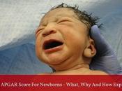 APGAR Score Newborns What, Explained