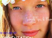 Skin Pigmentation: Simple Tips Remedies