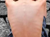 Philosophical Friday: Population Bioethicist Strikes Back Critics