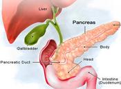 Dealing with Chemotherapy Help Quit Pancreatic Cancer