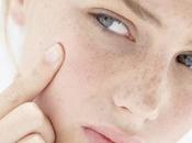 Diet Tips Nourish Skin