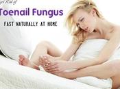 Toenail Fungus Fast Naturally Home