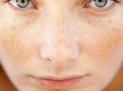Excellent Home Remedies White Spots Skin