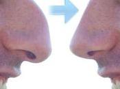 Plastic Surgery Simulator v1.2.12