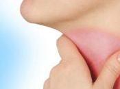 Facts Remedies Should Know About Sore Throats