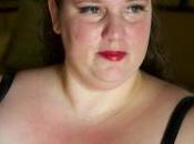 Double Chin? Have Tried Injecting Acid?