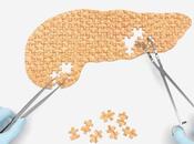 Fatty Pancreas Development Type Diabetes