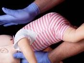 Child Care &#8211; What Baby Choking
