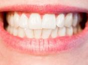 Smile! It’s Still Possible Perfect White Teeth