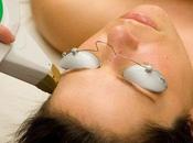 Photofacials Laser Skin Treatments