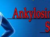 Herbal Remedies Ankylosing Spondylitis Symptoms Diagnosis