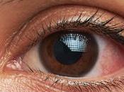 Mistakes Avoid Your Eyes