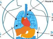 What Cause Mesothelioma