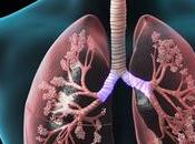 Treat Chronic Obstructive Pulmonary Disease (COPD) Ayurveda