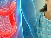 What Foods Avoid Have Ulcerative Colitis