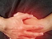 Benefits Terminalia Arjuna Treating Ulcerative Colitis