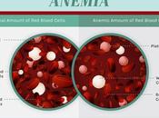 Anemia Ayurvedic Perspective, Herbal Remedies More