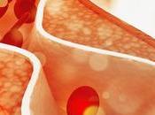 NuSI Study Raises Potential Concerns About Keto Diet