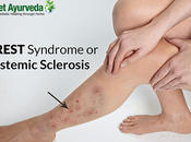 Systemic Scleroderma Rare Auto-Immune Disease!