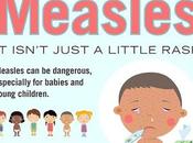 [Best] Measles Symptoms Causes Health News Today