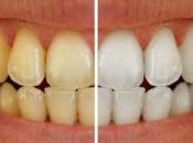 Methods Remove Yellow Teeth Dentists Coimbatore