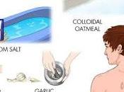 Which Best Psoriasis Home Remedies?