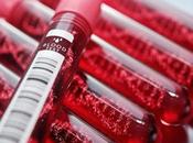 Reasons Women Should Keep Check Their Hemoglobin Levels