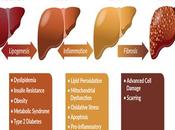 Ayurvedic Management Non-Alcoholic Fatty Liver Disease (NAFLD)