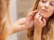Acne: Healing Touch Chandigarh Ayurved Centre