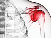 Treatment Frozen Shoulder Ayurveda