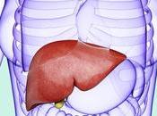 Ayurvedic Medicine Treatment Liver Cirrhosis