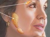 Most Effective Treatment Sjogren’s Syndrome